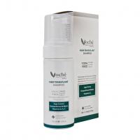 شامپو موهای کاشت شده وچه150 میل