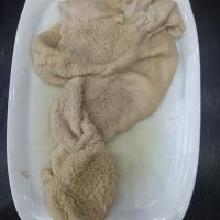سیرابی جگر یک پرس